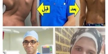 الإعلامية عبير هلال تحاور أسطورة الجراحات الخطيرة للعمود الفقري الدكتور هاني عبد الجواد
