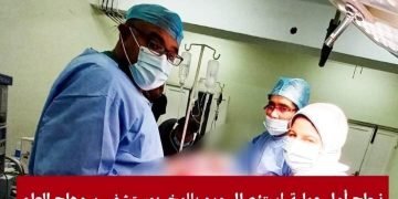 نجاح أول عملية استئصال ورم بالمخ لمسن بمستشفى سوهاج العام