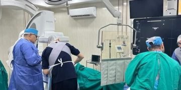 بدء تشغيل أحدث جهاز للقسطرة المخية بمركز جراحة المخ والأعصاب بجامعة المنصورة