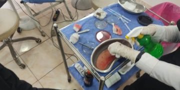 دبلوم تجارة ويزرع الشعر