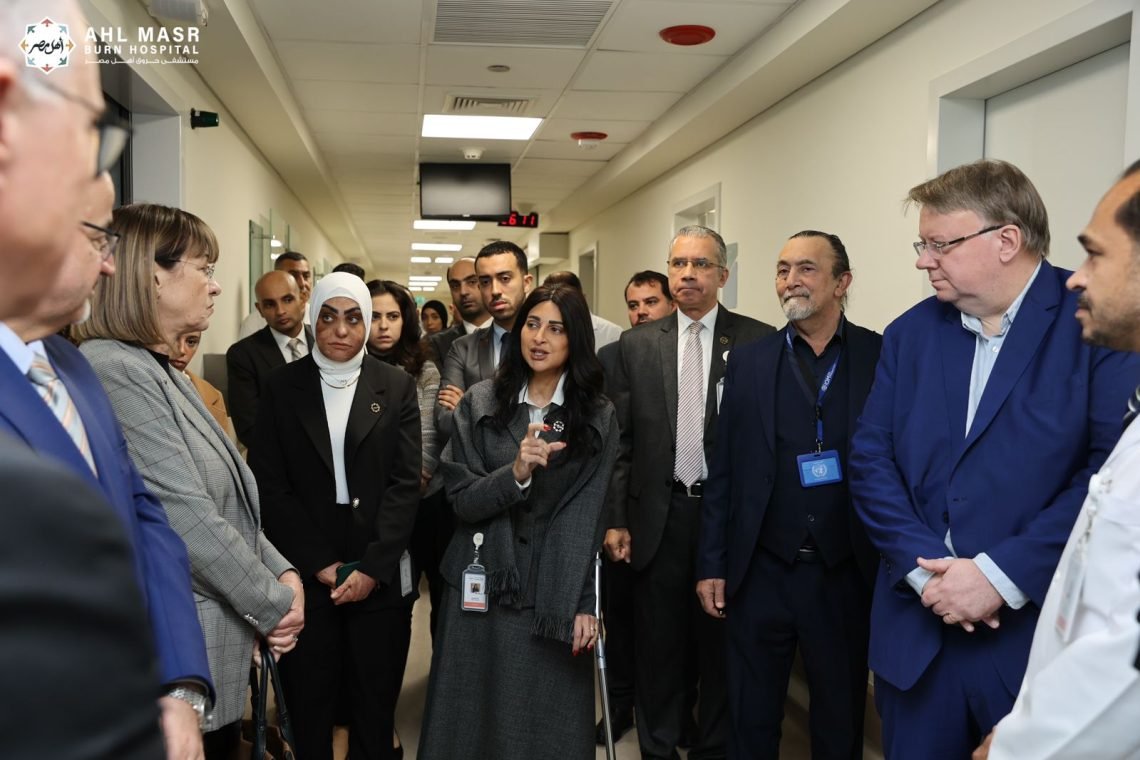 الأمم المتحدة في مستشفى حروق أهل مصر