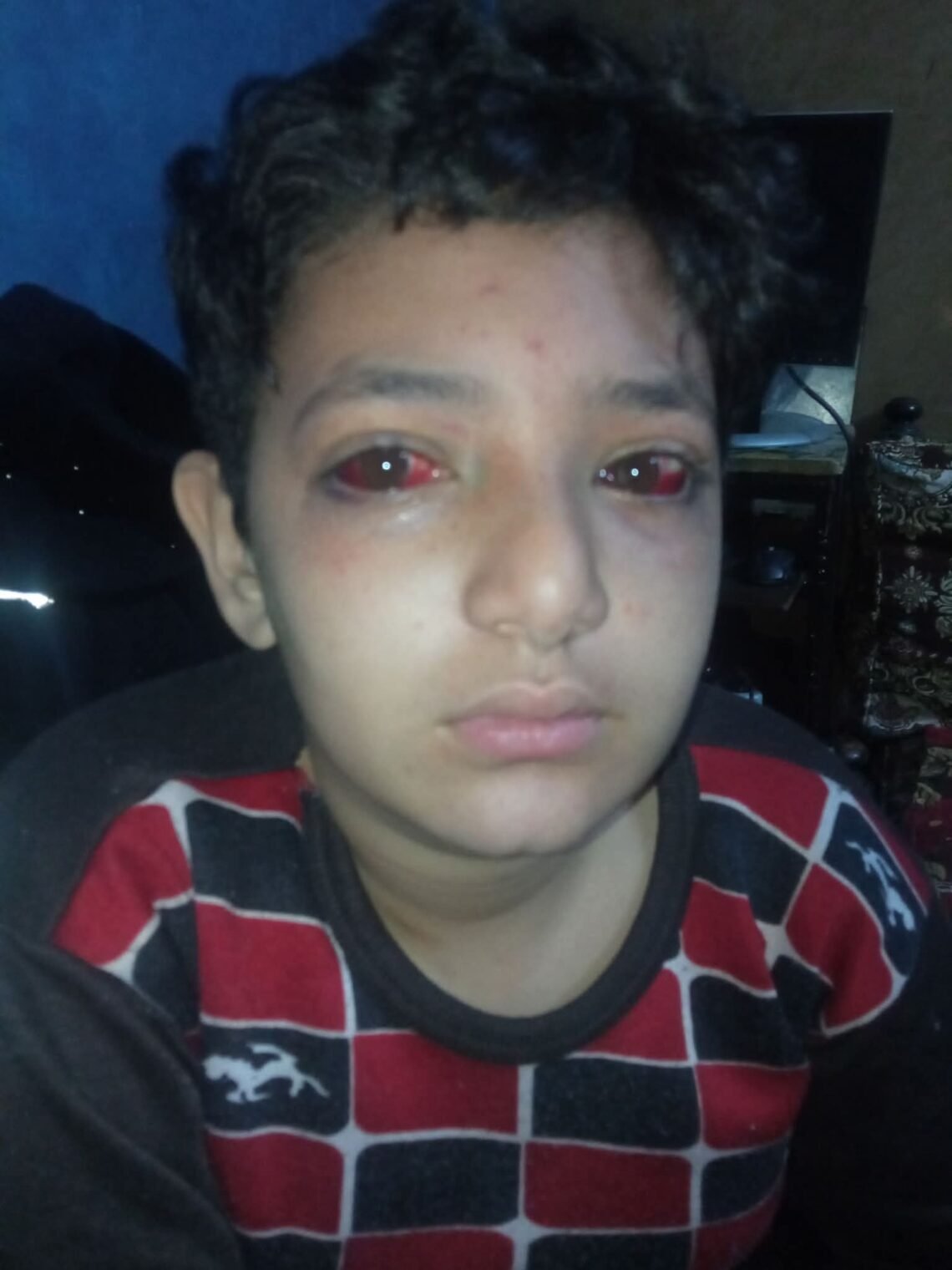 إدارة بولاق الدكرورالتعليمية  إلغاء تكليف مدير مدرسة  وتوقيع الجزء عليه بعد إصابة طالب