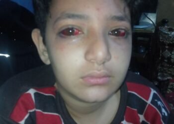 إدارة بولاق الدكرورالتعليمية  إلغاء تكليف مدير مدرسة  وتوقيع الجزء عليه بعد إصابة طالب