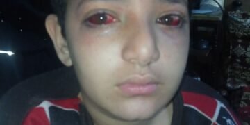 إدارة بولاق الدكرورالتعليمية إلغاء تكليف مدير مدرسة وتوقيع الجزء عليه بعد إصابة طالب